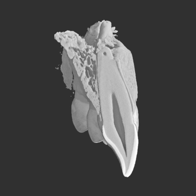 Indicazioni all'utilizzo della CBCT in parodontologia