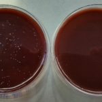 Utilizzo di un nuovo sistema a pressione negativa apicale per la detersione e la disinfezione dei canali radicolari: studio ex-vivo