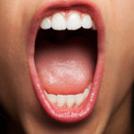 Ematoma del pavimento della bocca Ematoma del pavimento della bocca