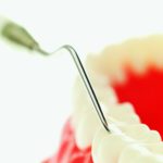 Protocolli di carico implantare nelle edentulie parziali Protocolli implantari