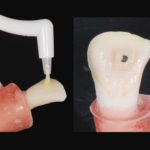 L’incollaggio delle ceramiche allo smalto