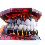 Black triangle syndrome: l’assenza della papilla interincisale dm_IL DENTISTA MODERNO_ Black triangle syndromel'assenza della papilla interincisale