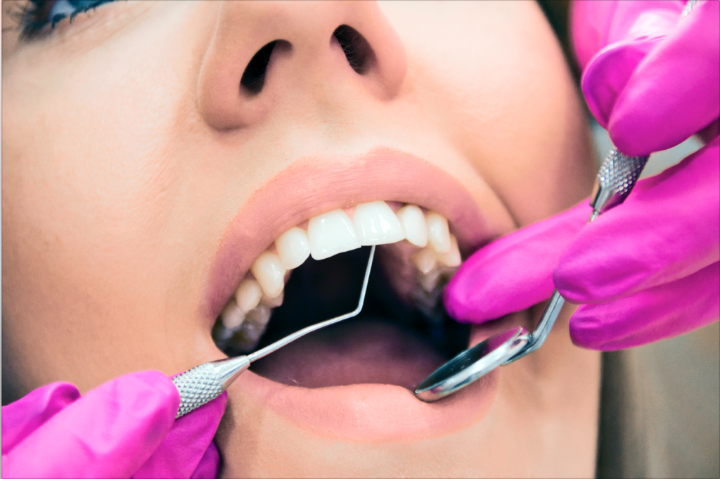 DM_il dentista moderno_Vetroceramiche e disilicati