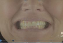 Il progetto digitale per il ripristino della dimensione verticale