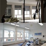 Protesi e sbiancamento: gestione del trattamento dopo i restauri