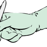 Aggiornamenti sul trattamento chirurgico delle tasche parodontali residue DM_il dentista moderno_trattamento chirurgico delle tasche parodontali