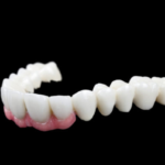 Zirconia: stabilità cromatica e valutazioni colorimetriche DM_il dentista moderno_zirconia