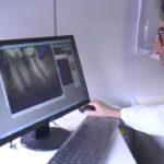 La cavità d’accesso in endodonzia spiegata da Gianluca Fumei