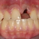 Traumatologia dentale: le linee guida, preziose come la check-list
