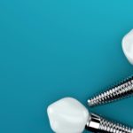 Fattori di rischio del fallimento implantare tardivo DM_il dentista moderno_Fattori di rischio nel fallimento a breve termine in implantologia