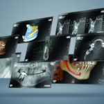 La radiologia 3D di oggi e di domani: KaVo presenta quattro workshop
