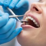 Implicazioni cliniche della nuova classificazione della malattia parodontale DM_il dentista moderno_classificazione malattia parodontale