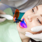 Questione amalgama: l’opinione di ANDI DM_il-dentista-moderno_amalgama