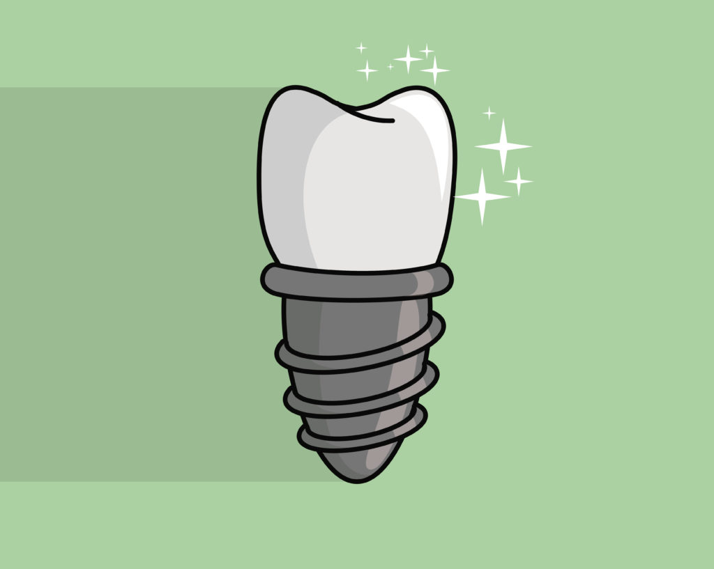 DM_il-dentista-moderno_Implantologia-nel-paziente-con-osteoporosi.