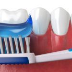 Dentifrici fai da te: la moda che danneggia i denti DM_il-dentista-moderno_dentifricio.jpg