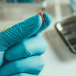 Ritrattamento canalare: determinazione della lunghezza di lavoro DM_il-dentista-moderno_ritrattamento-canalare_lunghezza-di-lavoro_endodonzia