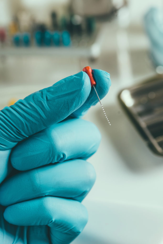 DM_il-dentista-moderno_ritrattamento-canalare_lunghezza-di-lavoro_endodonzia