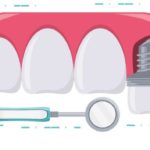 Amelogenine nella rigenerativa del sito affetto da perimplantite
