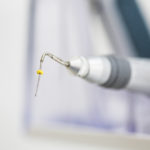 Movimento rotante e reciprocante a confronto nel ritrattamento DM_il dentista moderno_movimento rotante