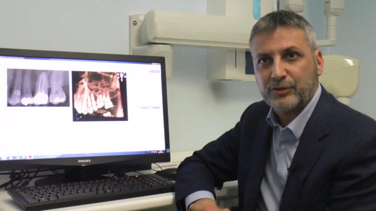 La CBCT in endodonzia