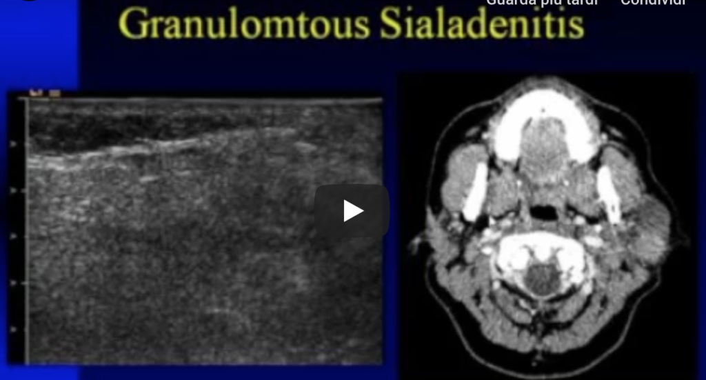 DM_il dentista moderno_Ecografia in odontoiatria
