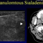 Ecografia in odontoiatria DM_il dentista moderno_Ecografia in odontoiatria