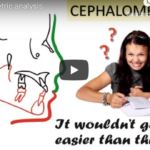 Agenesia del terzo molare e alterazioni craniometriche DM_il dentista moderno_cefalometria_terzo molare_agenesia