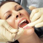 Xerostomia nel paziente diabetico