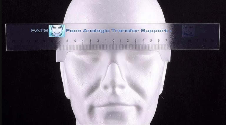 Comparazione tra misurazioni analogiche e digitali nello Smile Design