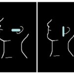 Articolazione temporomandibolare: studio ecografico della morfologia del condilo mandibolare