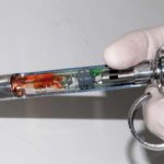 Allergie agli anestetici locali in odontoiatria: procedure consigliate e forme di anestesia alternativa