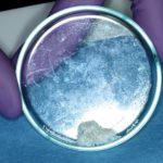 L’acido ialuronico come nuovo materiale di rigenerazione parodontale