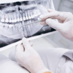 Rigenerazione ossea di difetti infraossei: i risultati di una metanalisi Dm_il-dentista-moderno_diagnosi-in-parodontologia._difetti infraossei