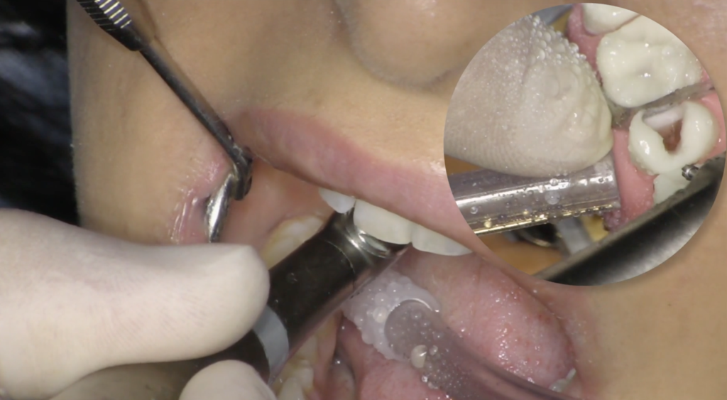 classe_diagnosi_interprossimali