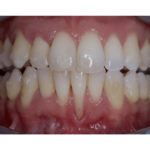 Terapia parodontale e aspetti interdisciplinari