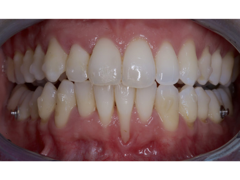 Terapia parodontale e aspetti interdisciplinari