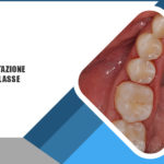 Riabilitazione II Classe: risoluzione di criticità e semplificazioni