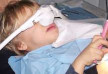 Sedazione cosciente, istruzioni per l’uso