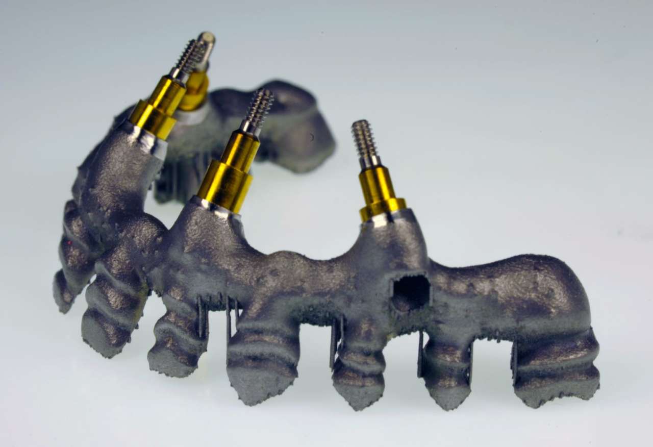 Una soluzione innovativa per la protesi fissa