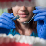 La pulpotomia dei denti decidui: quali sono i materiali più adatti? DM_il-dentista-moderno_MTA-E-biodentine_pulpotomia