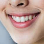 Metodi predittivi dell’espansione rapida del palato con programmazione CBCT DM_il dentista moderno_espansione del palato