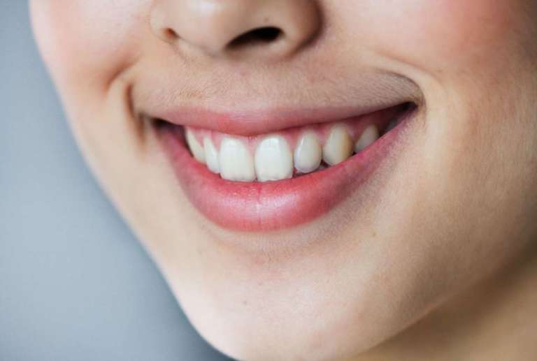 Metodi predittivi dell'espansione rapida del palato con programmazione CBCT