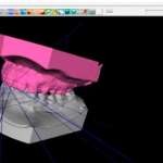 ABO Discrepancy Index Valutazione di due sistematiche