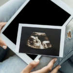 Lesioni orali più comuni in gravidanza: indicazioni di una review Dm_il dentista moderno_gravidanza e odontoiatria