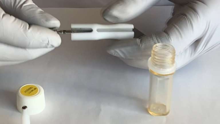 La consapevolezza del paziente in implantologia