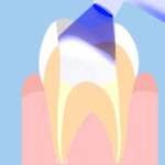 Possiamo chiedere di più ai nuovi compositi flow?