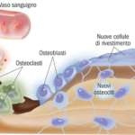 Le lesioni ossee benigne della cavità orale