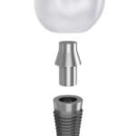 Una futura metodica di monitoraggio implantare? DM_il-dentista-moderno_impianto_implantologia_isq_monitoraggio implantare