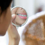 Prevalenza dell’agenesia congenita dell’incisivo laterale superiore tra adolescenti: uno studio di interesse ortodontico DM_il-dentista-moderno_ortodonzia_seconda-classe_ASIO