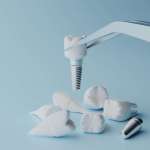 Effetto protettivo del consumo lieve di alcool sulla salute perimplantare salute perimplantare